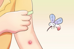 哪个血型最招蚊子：与血型无关(六种人最招蚊子)