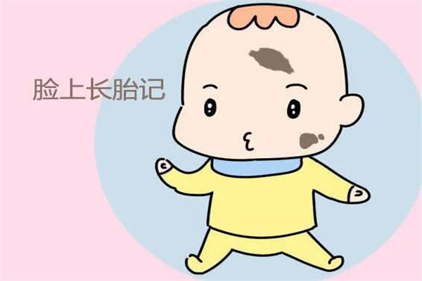 胎记治疗一般多少钱?最低1000元起(根据面积大小决定)