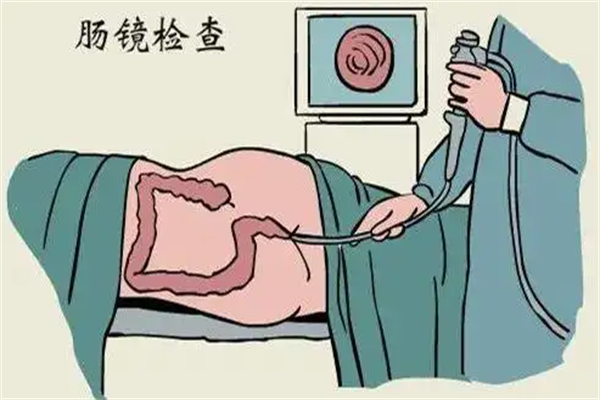 为什么不建议年轻人做肠镜？患病几率低（具体看病人情况）